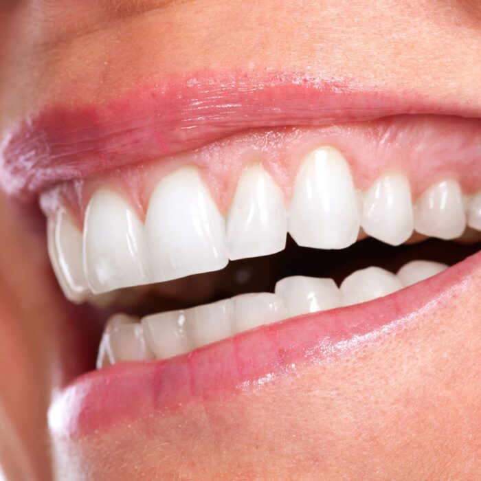 Don't Forget About Your Gums | Arlington Heights IL Dentist